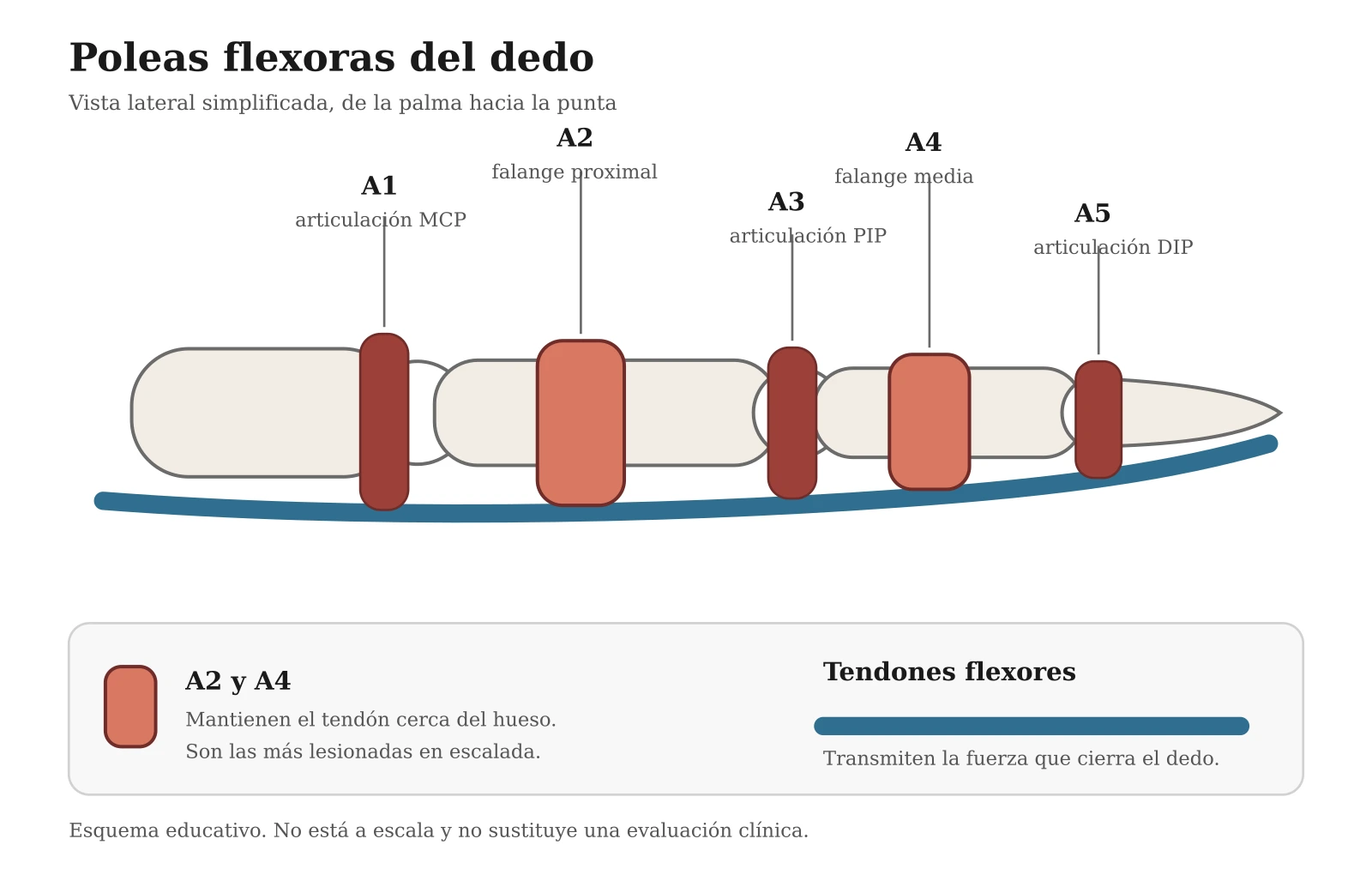 Esquema lateral de un dedo que identifica las poleas A1 a A5 y destaca A2 y A4 sobre las falanges proximal y media.